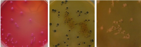 沙門、志賀菌屬瓊脂(SS)對照培養基