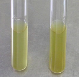 大腸埃希菌在培養基中的生長情況